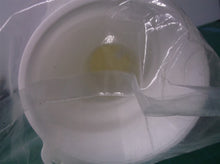 (25) Kidney Stone Collector Funnel with Mesh Screen Filters